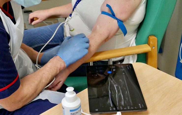 Same Day Emergency Care Department using Lumera equipment to detect blood clots