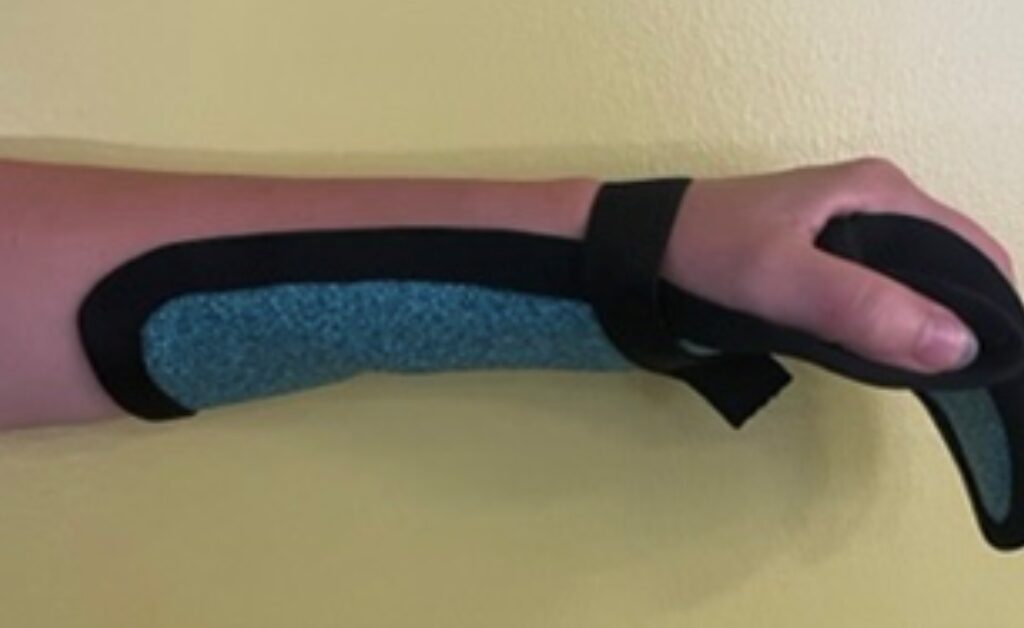 WoodcastSplintsFeatured