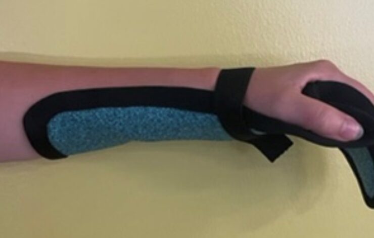 WoodcastSplintsFeatured